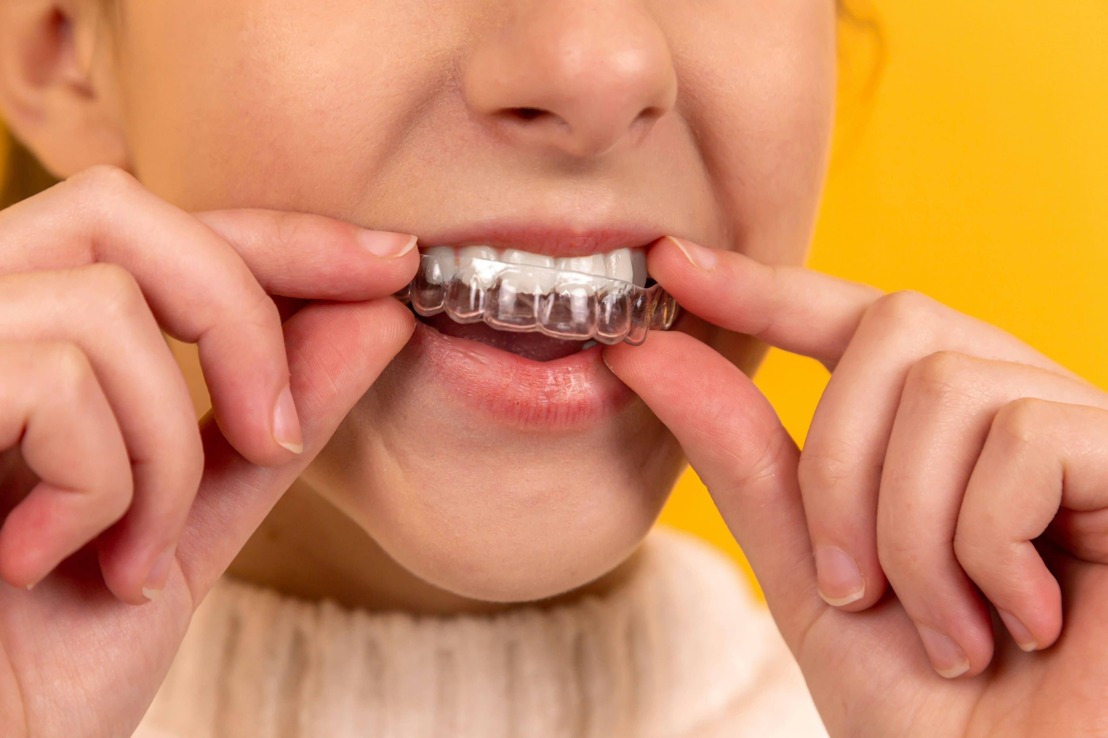 Dental service